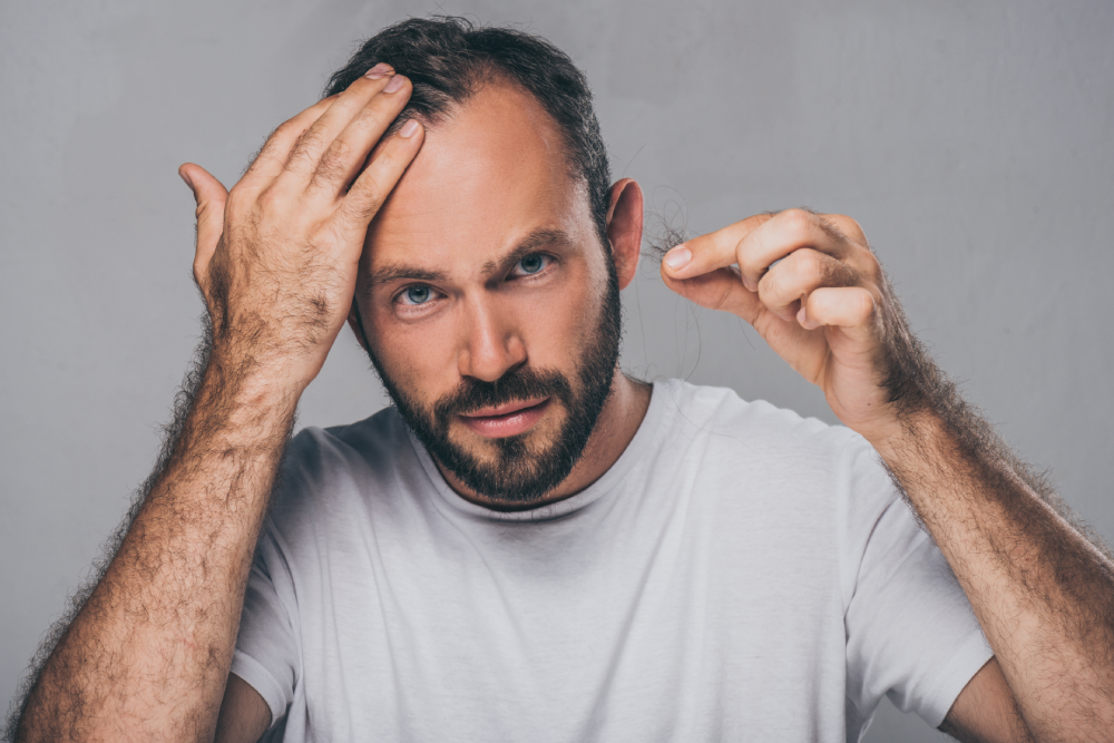 Concerned man with thinning hair holding fallen strands, symbolizing early signs of hair loss and need for hair restoration.