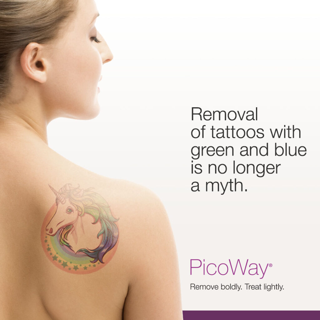 Remove green and blue tattoos with PicoWay