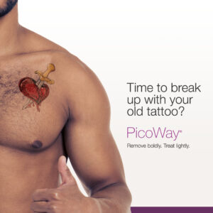 PicoWay Laser Tattoo Removal