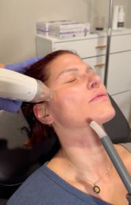 Biostimulator Treatment at Introspect Wellness