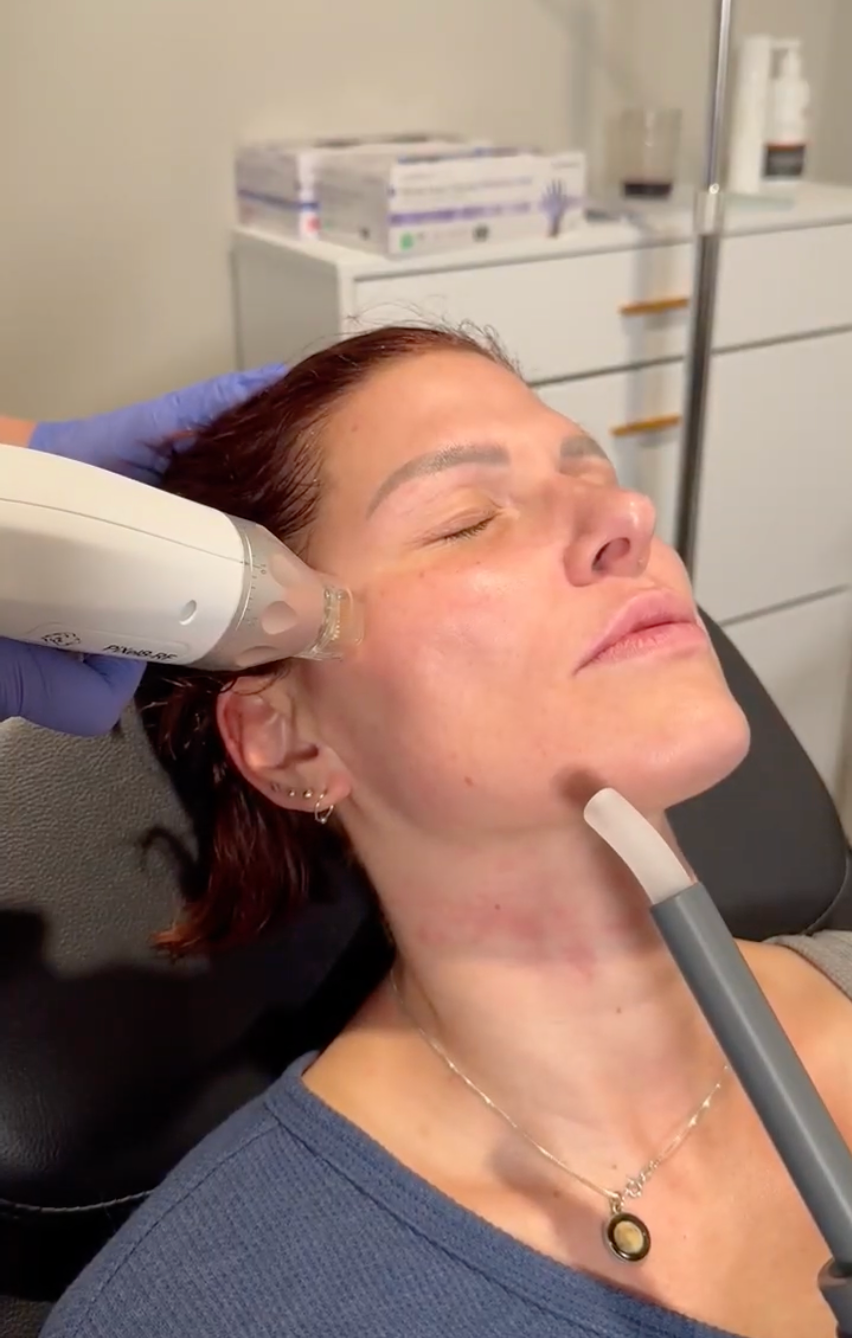 Biostimulator Treatment at Introspect Wellness